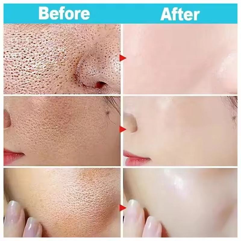 MOOYAM Rice Serum pore minimizing before and after