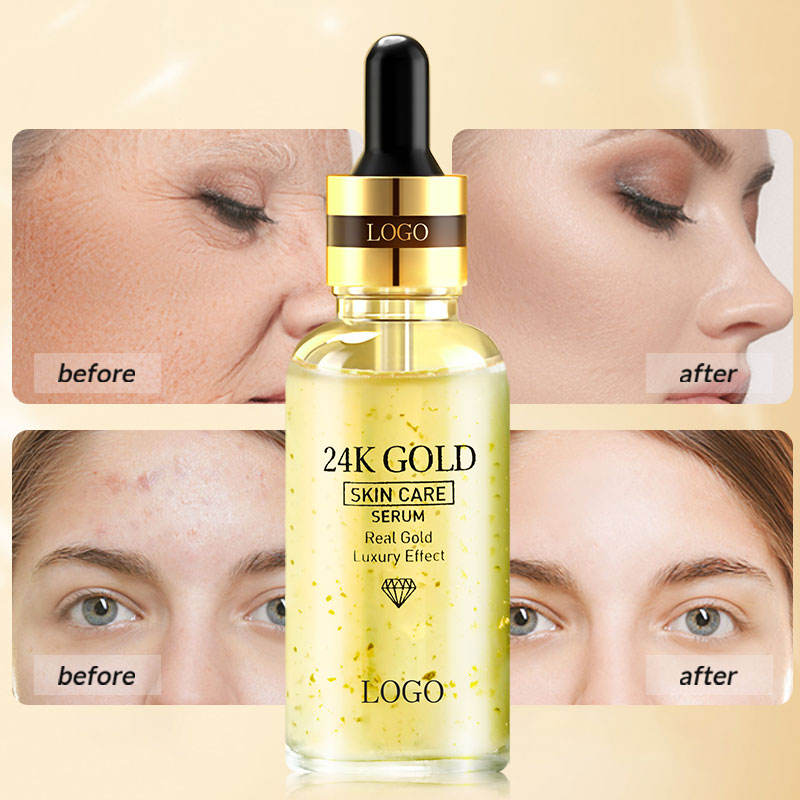 24K Gold Serum anti-ageing before and after wrinkle reduction